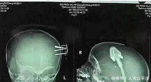 关于人民，关于战争